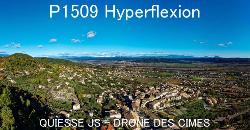 P1509 Hyperflexion