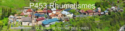 P453 Rhumatismes
